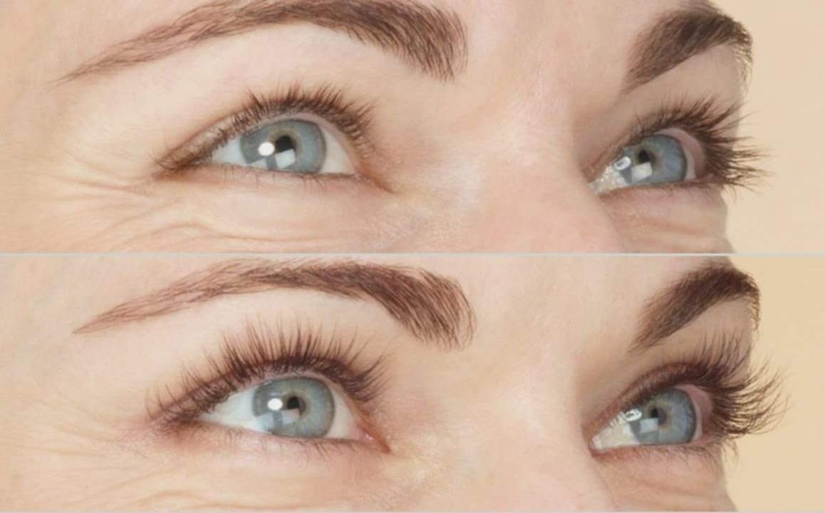 bimatoprost for eyebrow and eyelash growth 3