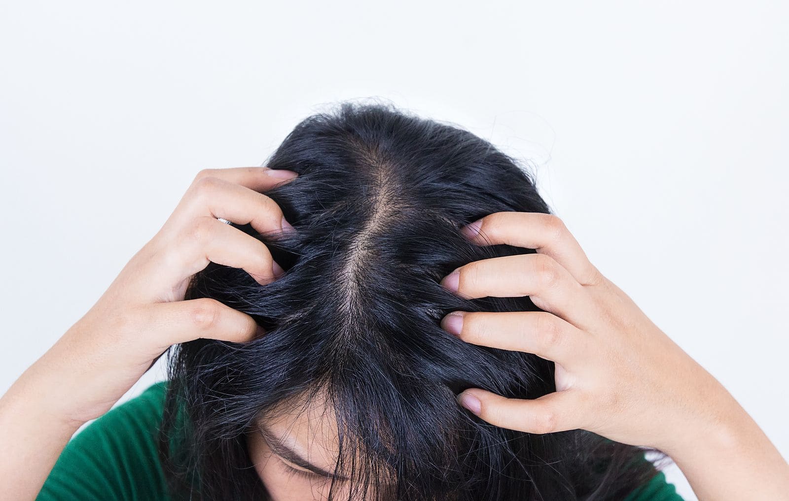 what to do if your scalp hurts and your hair is falling out 2